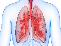 Бедаквилин: применение в педиатрии