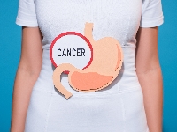 Российско-японский симпозиум «Лечение рака желудка»