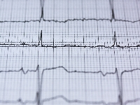 CardioQVARK —  ЭКГ в любое время в любом месте