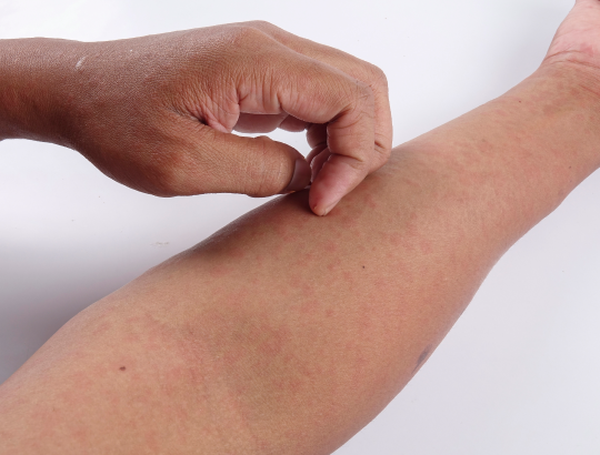 Энзалутамид: побочные действия и меры предосторожности