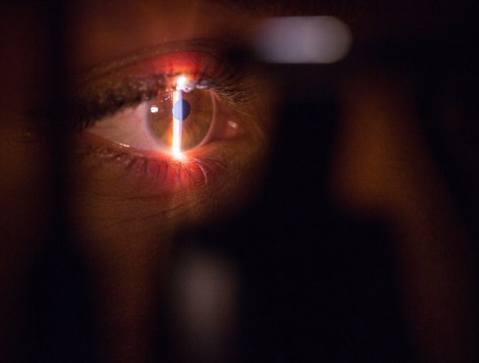 Даратумумаб: офтальмологические инфузионные реакции