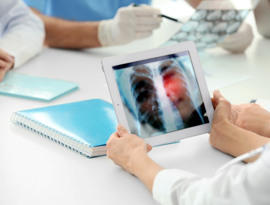 Рамуцирумаб: побочные действия, применение в педиатрии