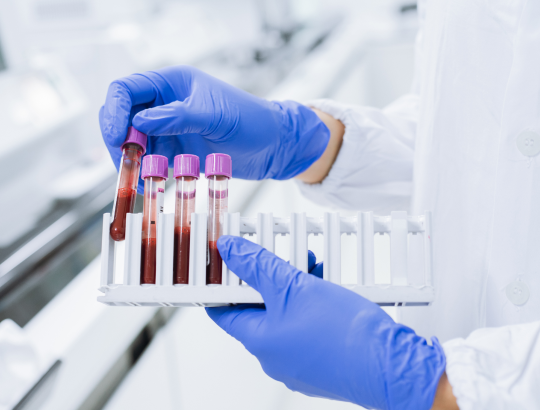 За первый месяц пилотного проекта неонатального скрининга выявлено 6 пациентов со СМА