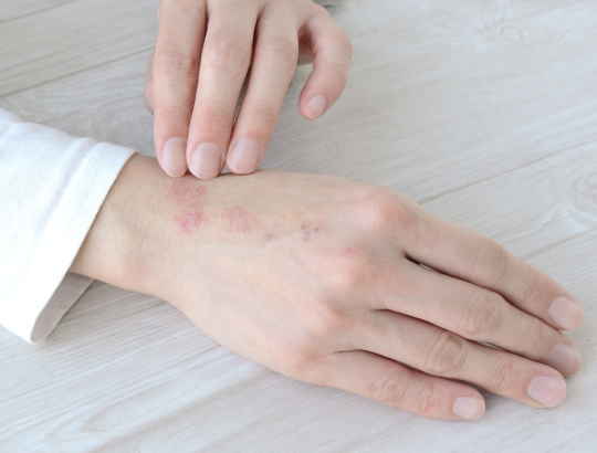 Дупилумаб — новая информация