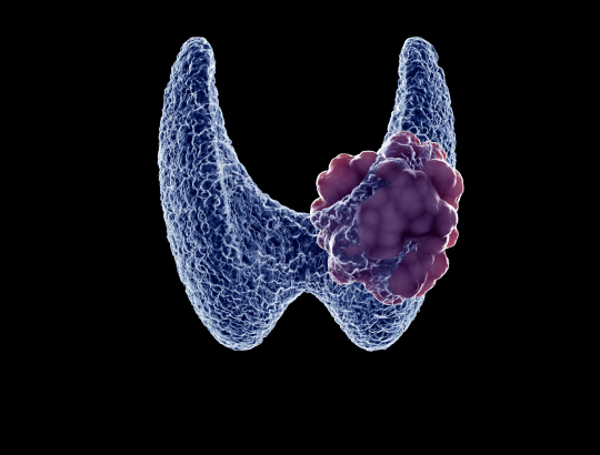 Сорафениб — новое описание