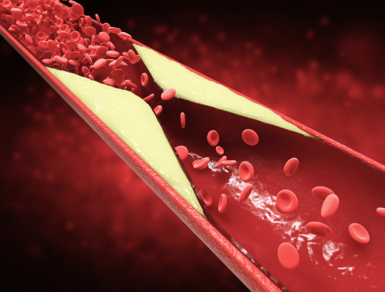 Варфарин — новое описание