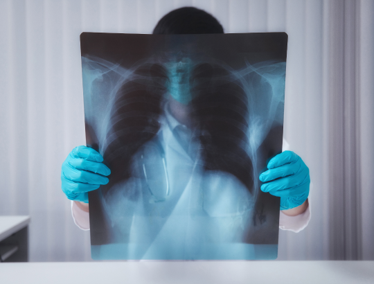 Гефитиниб — обновленное описание