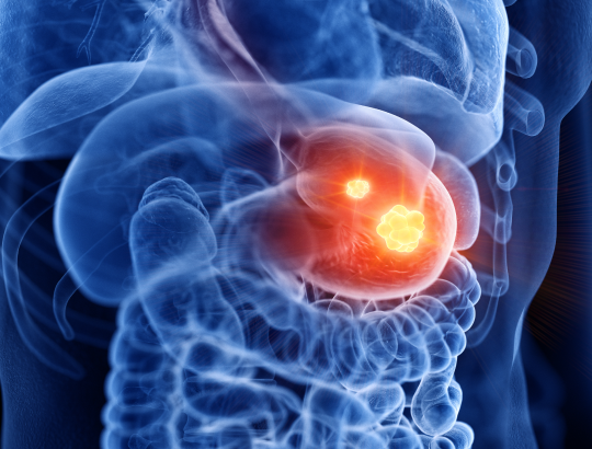 Омепразол — обновленное описание действующего вещества