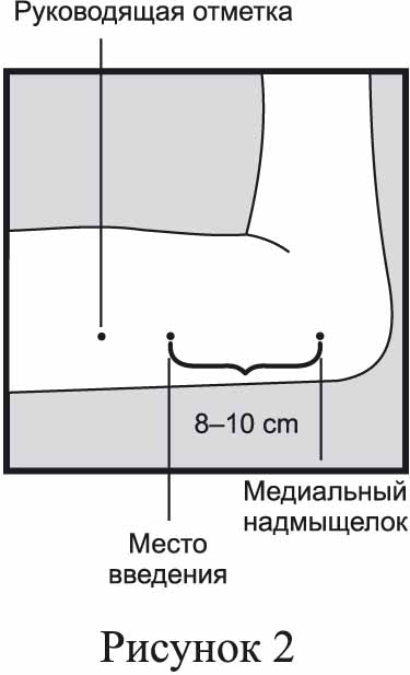 Импланон НКСТ — инструкция по применению, дозы, побочные действия .