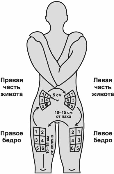 Куда делать укол в бедро схема