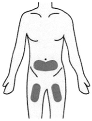 Способ применения и дозы Такзайро®