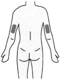 Способ применения и дозы Такзайро®