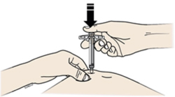 Способ применения и дозы Иринэкс®