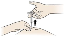 Способ применения и дозы Иринэкс®