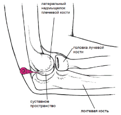 Способ применения и дозы ОСТЕОКОЛЛ® Плюс (OSTEOCOLL® Plus) Имплантат коллаген-содержащий