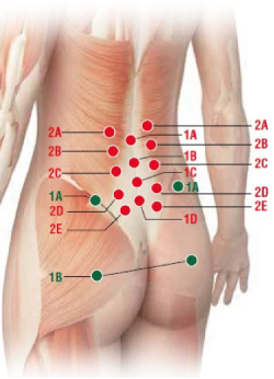Способ применения и дозы ОСТЕОКОЛЛ® Плюс (OSTEOCOLL® Plus) Имплантат коллаген-содержащий